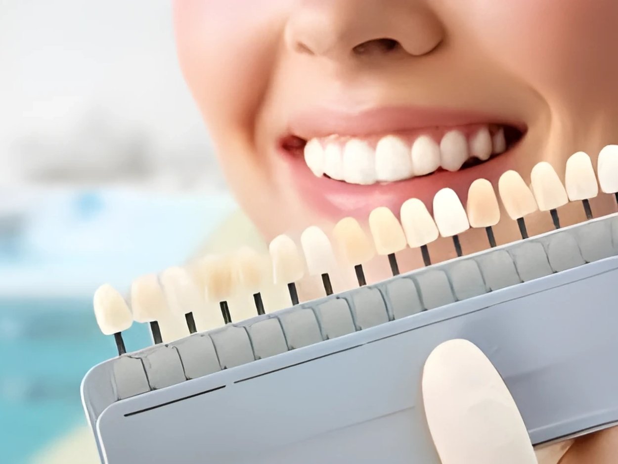 aesthetic dentistry