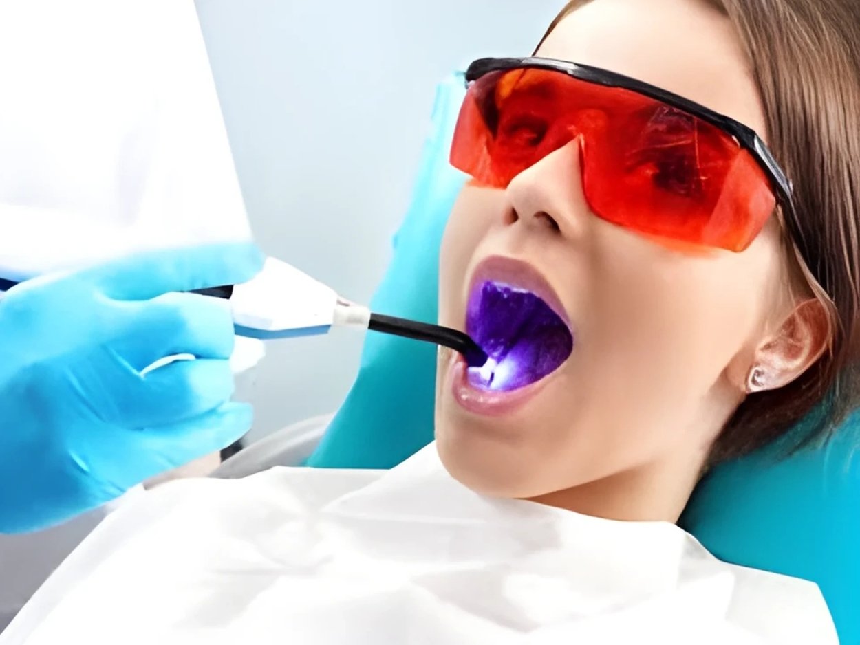 laser dentistry
